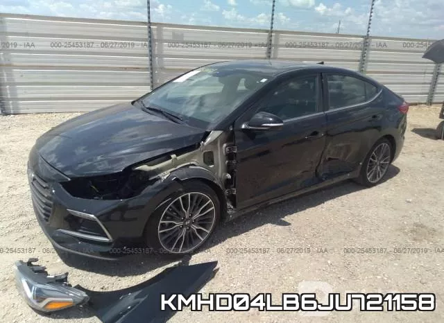 KMHD04LB6JU721158 фото 3