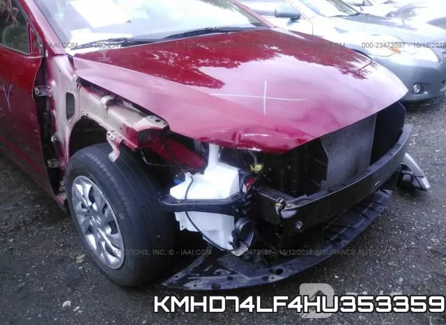 KMHD74LF4HU353359 фото 7