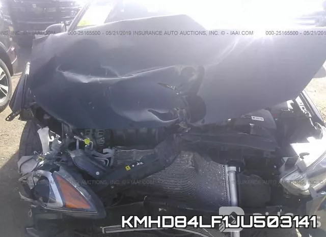 KMHD84LF1JU503141 фото 2