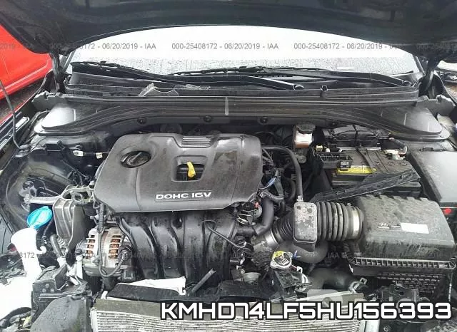 KMHD74LF5HU156393 фото 2