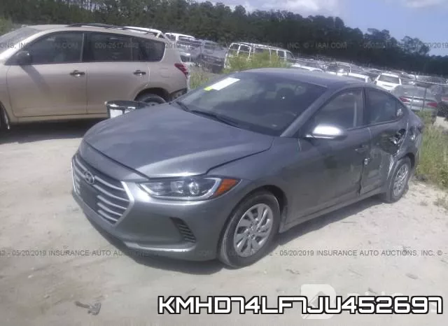 KMHD74LF7JU452697 фото 3