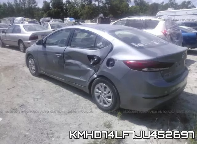 KMHD74LF7JU452697 фото 4