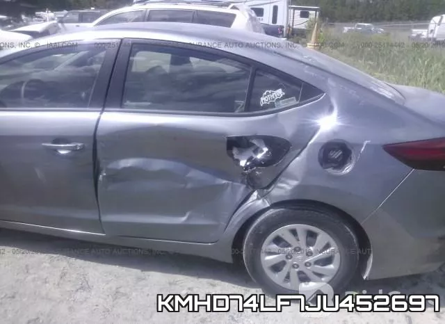 KMHD74LF7JU452697 фото 7