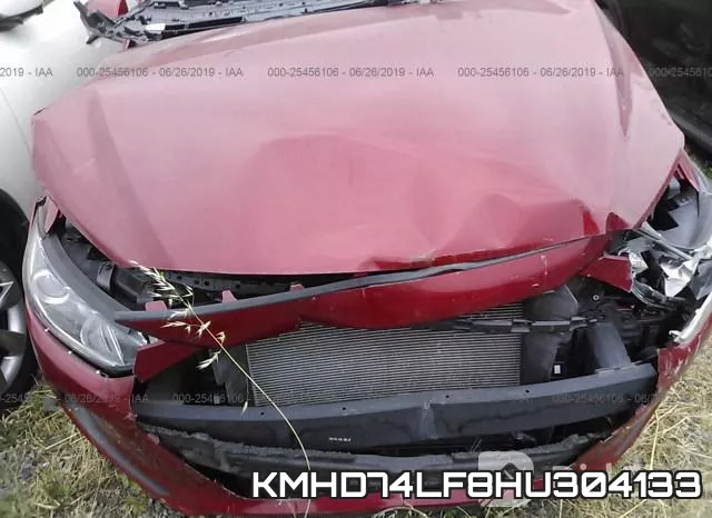 KMHD74LF8HU304133 фото 2