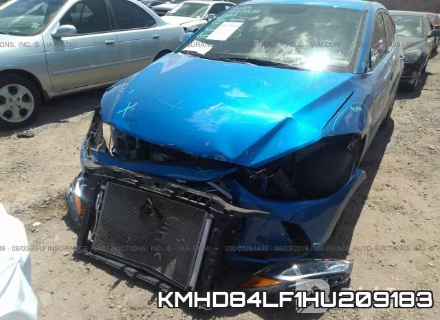 KMHD84LF1HU209183 фото 7