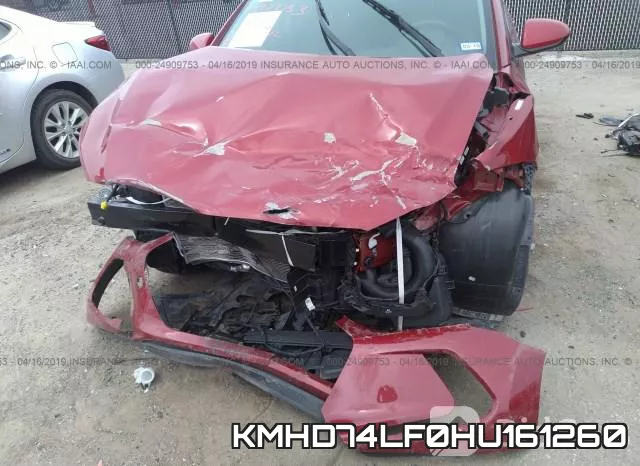 KMHD74LF0HU161260 фото 7