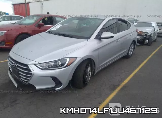 KMHD74LF1JU467129 фото 3
