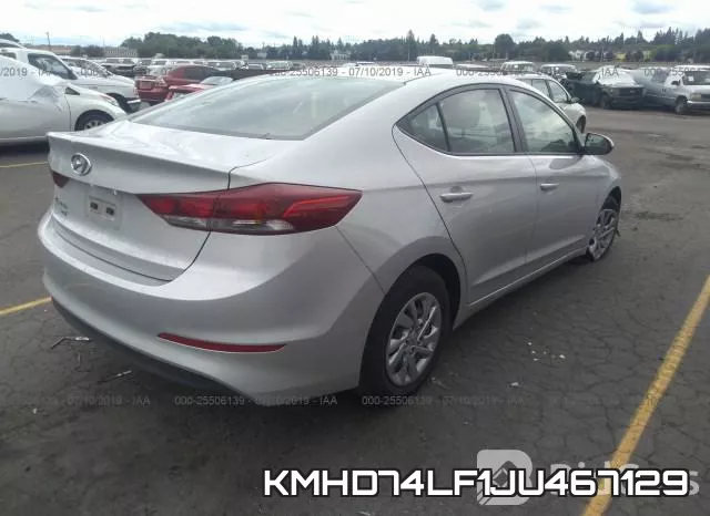 KMHD74LF1JU467129 фото 5