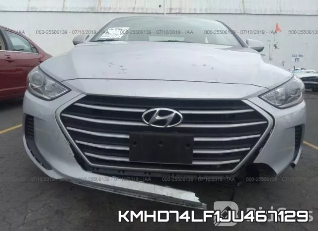 KMHD74LF1JU467129 фото 7