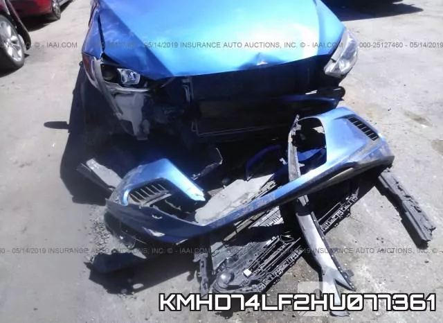 KMHD74LF2HU077361 фото 7