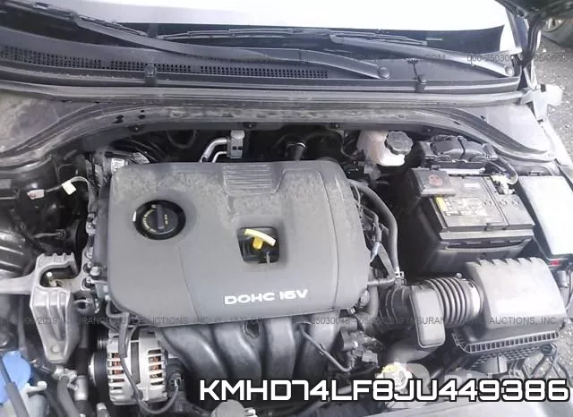 KMHD74LF8JU449386 фото 2