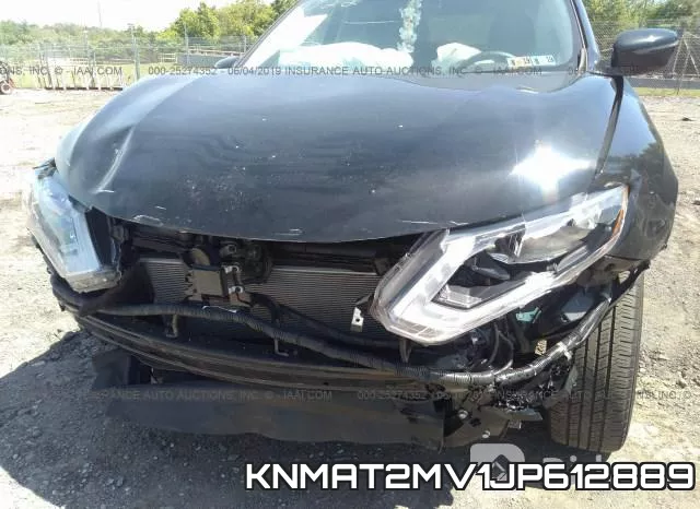 KNMAT2MV1JP612889 фото 7