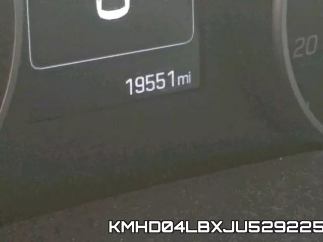 KMHD04LBXJU529225 фото 9