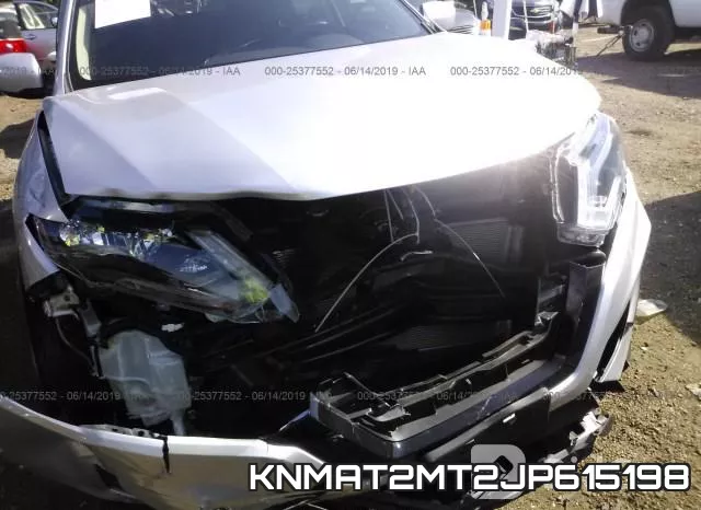 KNMAT2MT2JP615198 фото 7