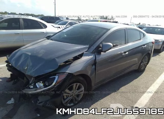 KMHD84LF2JU659785 фото 3