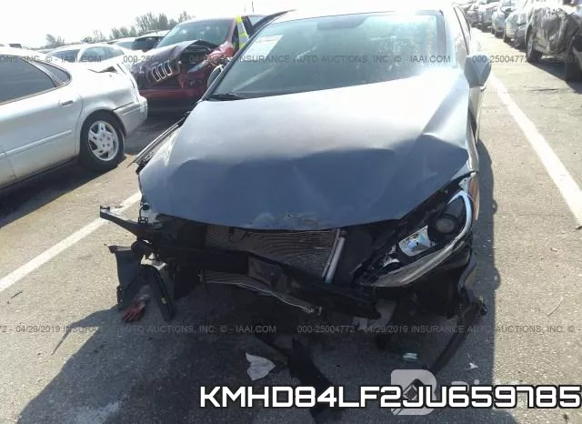 KMHD84LF2JU659785 фото 7