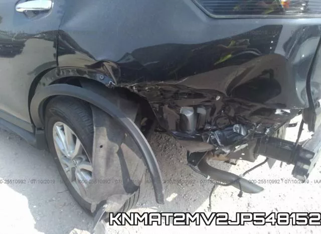 KNMAT2MV2JP548152 фото 7