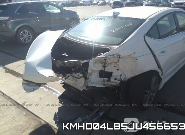 KMHD04LB5JU456653 фото 7