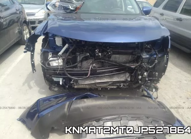 KNMAT2MT0JP527864 фото 7
