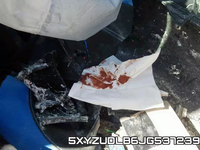 5XYZUDLB6JG537239 фото 10