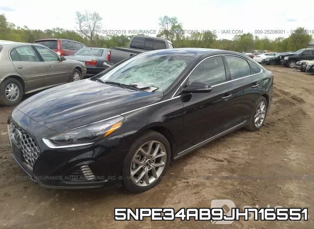 5NPE34AB9JH716551 фото 3