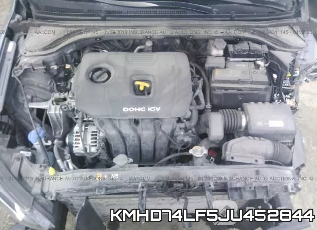 KMHD74LF5JU452844 фото 2