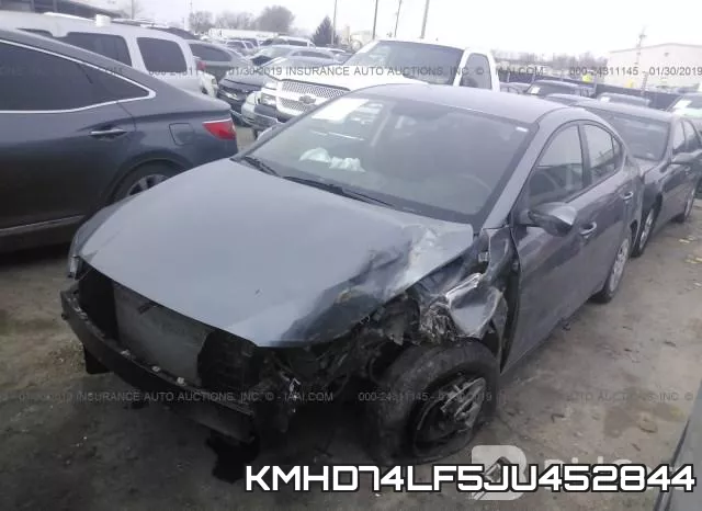 KMHD74LF5JU452844 фото 3