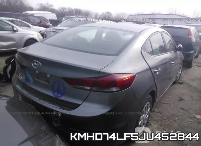 KMHD74LF5JU452844 фото 5