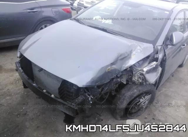 KMHD74LF5JU452844 фото 7