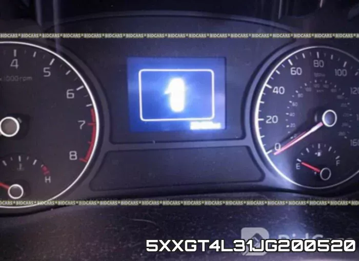 5XXGT4L31JG200520 фото 8