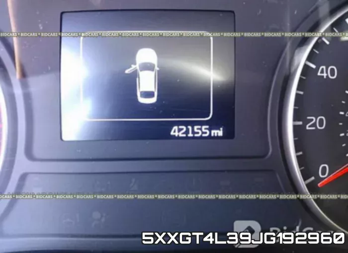 5XXGT4L39JG192960 фото 8