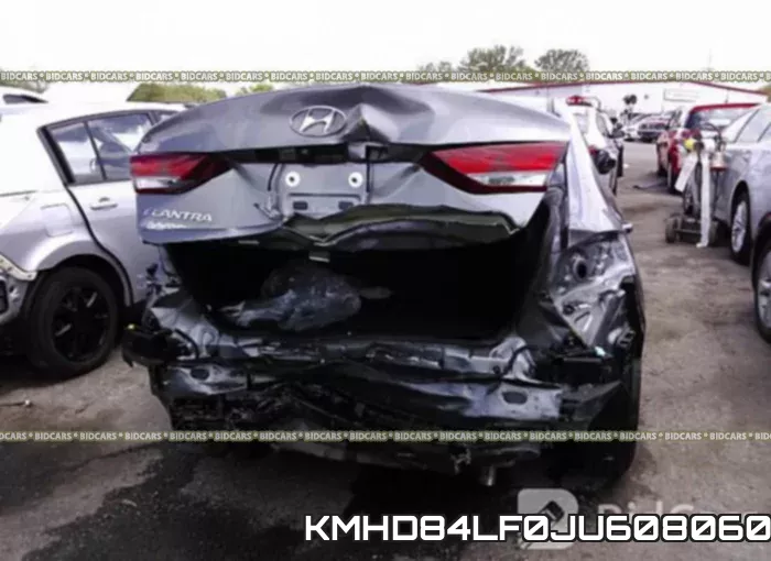 KMHD84LF0JU608060 фото 7