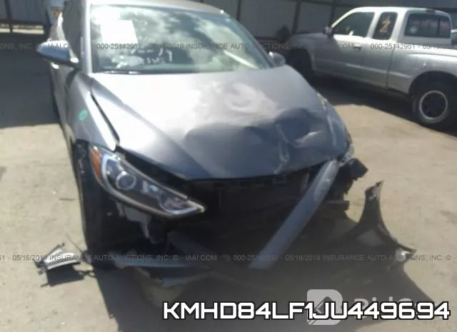 KMHD84LF1JU449694 фото 7