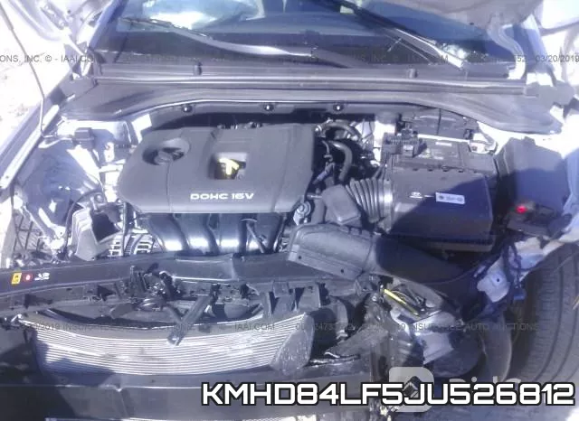KMHD84LF5JU526812 фото 2