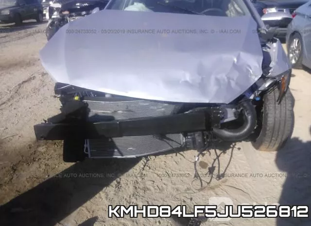 KMHD84LF5JU526812 фото 7