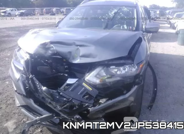 KNMAT2MV2JP538415 фото 7