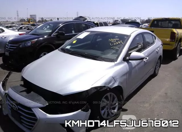 KMHD74LF5JU678012 фото 3