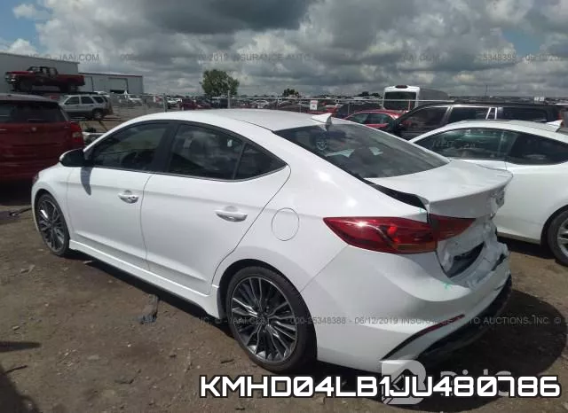 KMHD04LB1JU480786 фото 4