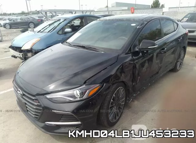KMHD04LB1JU453233 фото 3