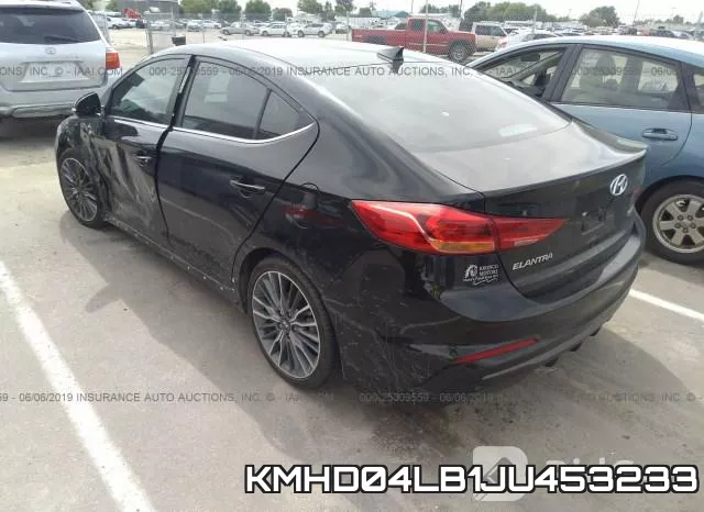 KMHD04LB1JU453233 фото 4