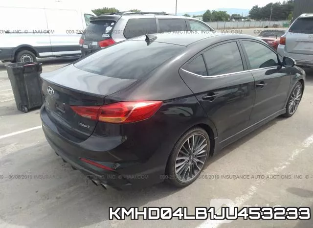 KMHD04LB1JU453233 фото 5