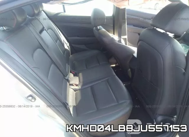 KMHD04LB8JU557153 фото 9