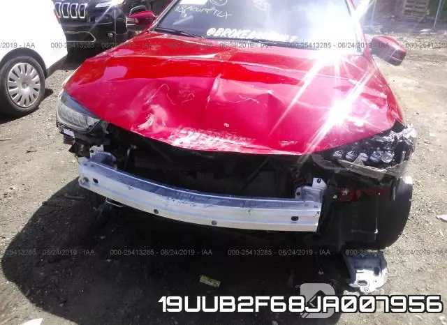 19UUB2F68JA007956 фото 7