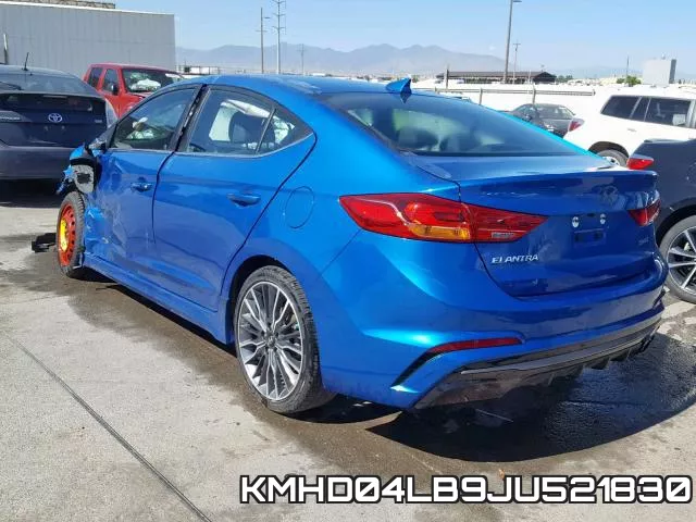 KMHD04LB9JU521830 фото 4