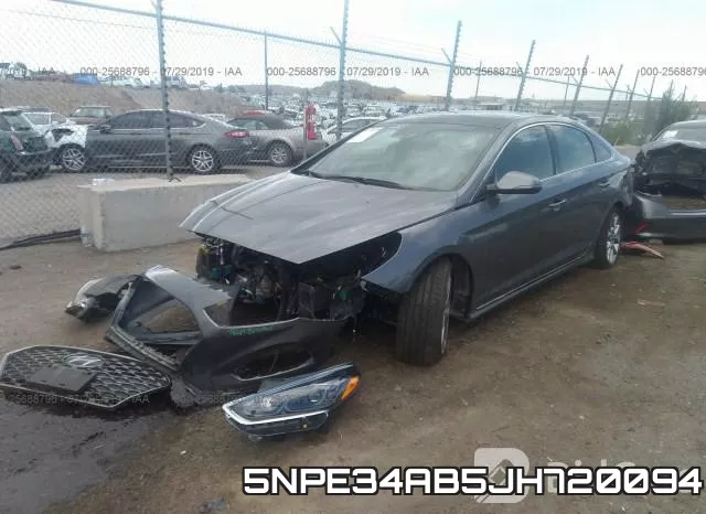 5NPE34AB5JH720094 фото 3