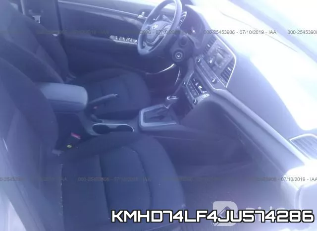 KMHD74LF4JU574286 фото 6
