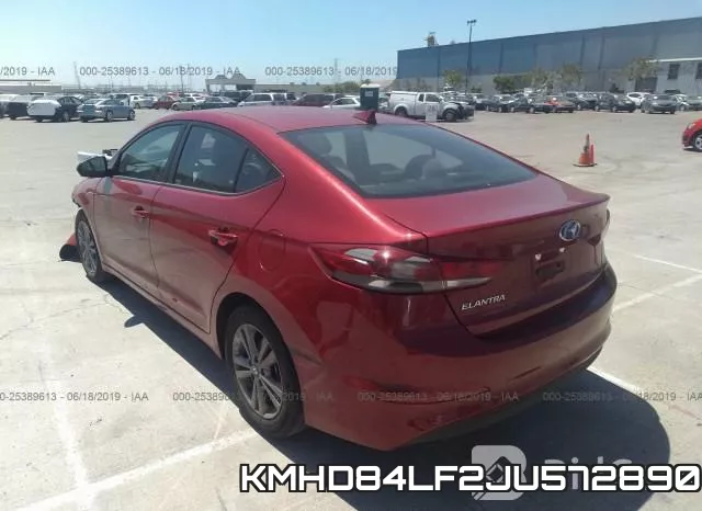 KMHD84LF2JU572890 фото 4
