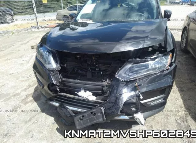 KNMAT2MV5HP602845 фото 7