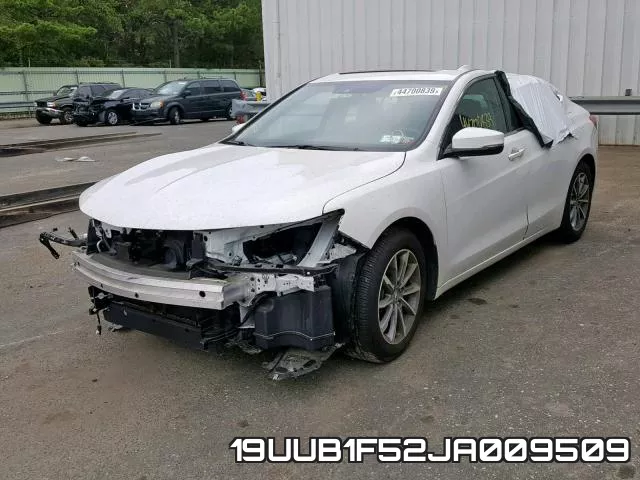 19UUB1F52JA009509 фото 3