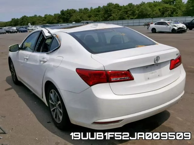 19UUB1F52JA009509 фото 4